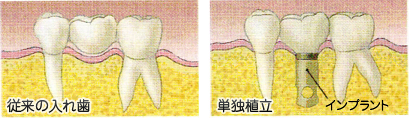 治療前後の比較イメージ
