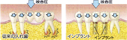 治療前後の比較イメージ