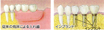 治療前後の比較イメージ